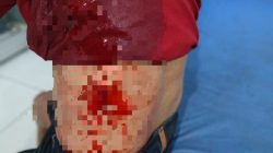Wartawan Media Cyber Nasional Banggai Laut Ditikam, Alami Lima Luka Tusukan